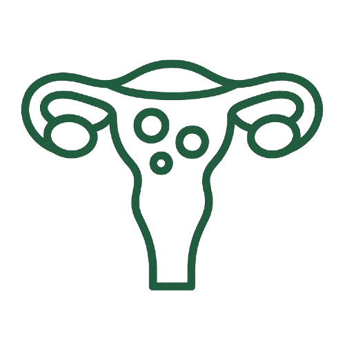 Uterine Fibroids